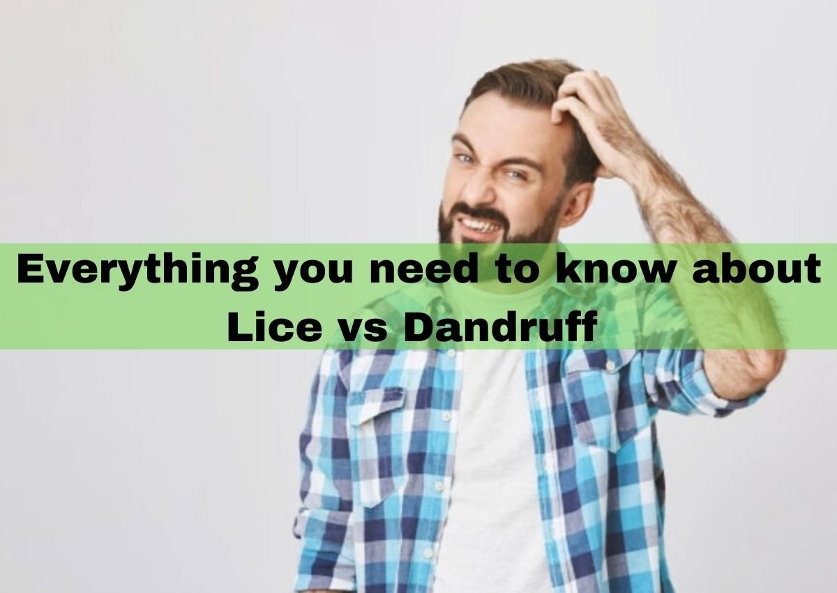 lice-vs-dandruff