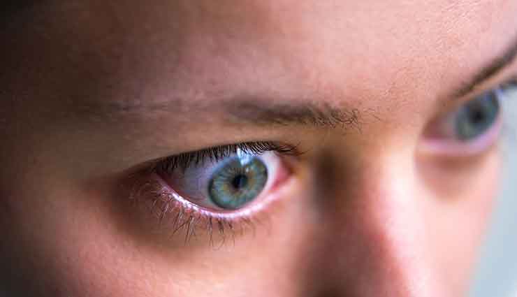 What is Thyroid Eye Disease? 
