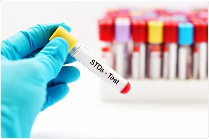 What STD Testing Should I Have and What Does it Take